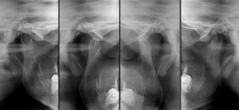 ATM - 4 Posições Digital