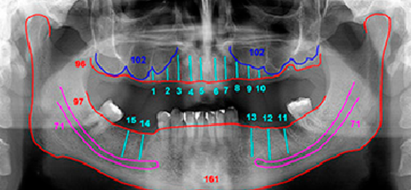 Panorâmica Mapeada Digital